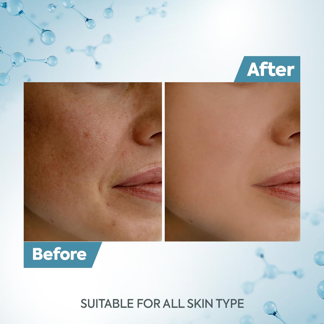 Raaga Professional DeTan Tan Removal Cream | Kojic & Milk | Reduces Tan, Dark Spots & Dullness | Dermatologically Tested, Peroxide & Sulphate Free - 72 g - Image 2